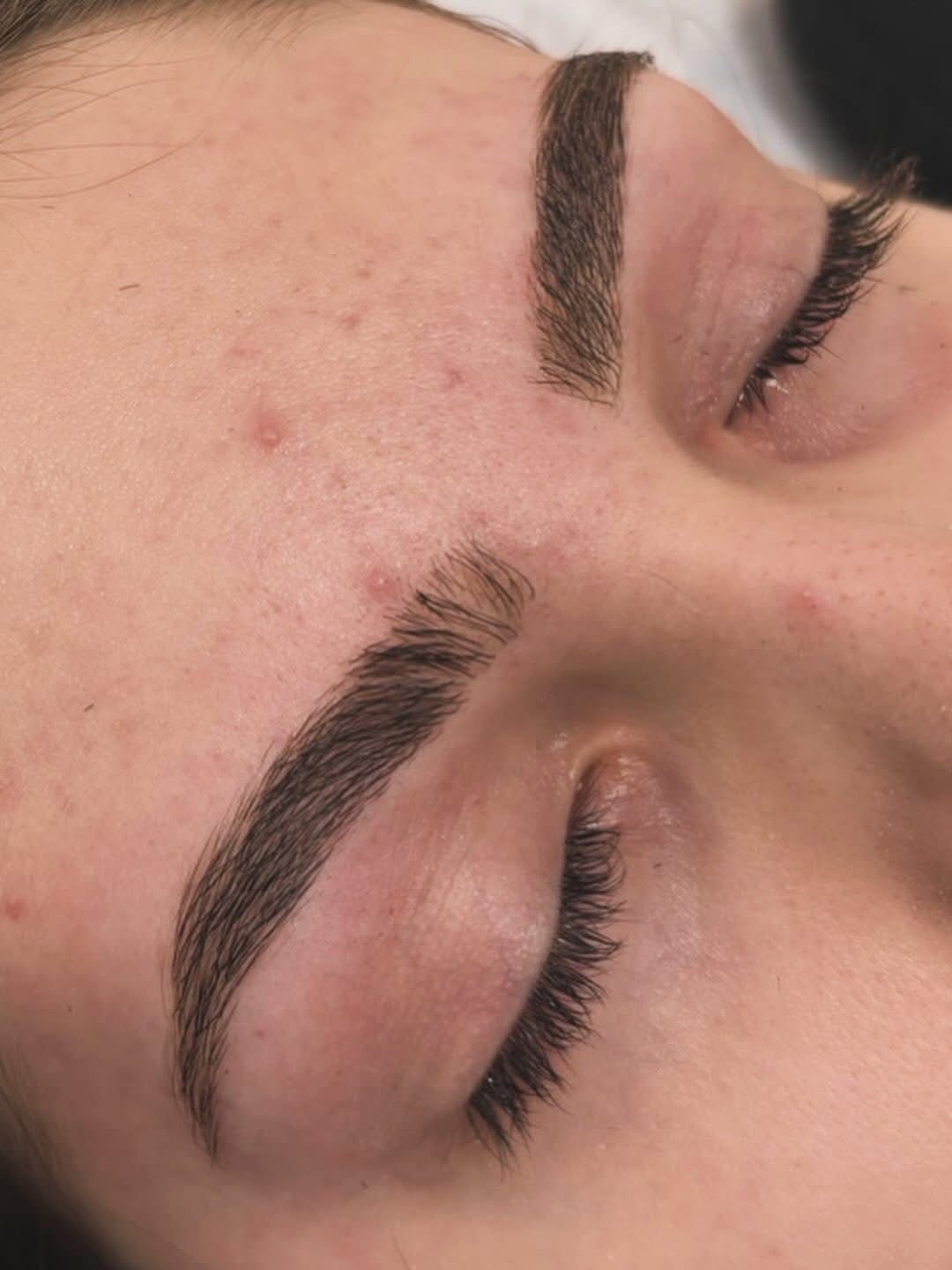 Imagem de Sombrancelha